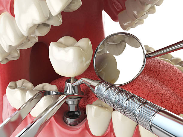 Best Broken Tooth Emergency  in Audubon, PA